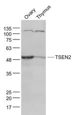 TSEN2 Antibody in Western Blot (WB)