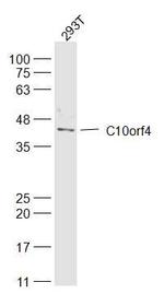 C10orf4 Antibody in Western Blot (WB)