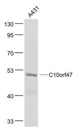 C10orf47 Antibody in Western Blot (WB)