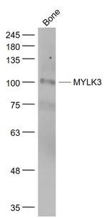 MYLK3 Antibody in Western Blot (WB)