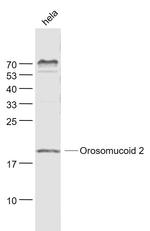 Orosomucoid 2 Antibody in Western Blot (WB)