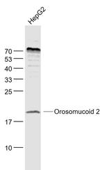 Orosomucoid 2 Antibody in Western Blot (WB)