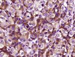 CRP Antibody in Immunohistochemistry (Paraffin) (IHC (P))