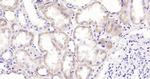 CRP Antibody in Immunohistochemistry (Paraffin) (IHC (P))