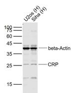 CRP Antibody in Western Blot (WB)