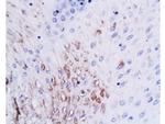 PAG608 Antibody in Immunohistochemistry (Paraffin) (IHC (P))