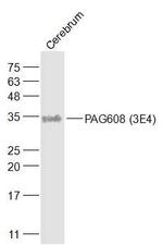 PAG608 Antibody in Western Blot (WB)