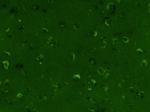 TIMP-1 Antibody in Immunohistochemistry (Paraffin) (IHC (P))