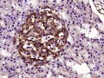 TIMP-1 Antibody in Immunohistochemistry (Paraffin) (IHC (P))