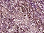 TIMP-1 Antibody in Immunohistochemistry (Paraffin) (IHC (P))