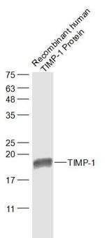 TIMP-1 Antibody in Western Blot (WB)