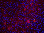 AFP Antibody in Immunohistochemistry (Paraffin) (IHC (P))