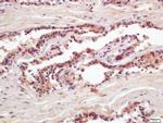 PSA Antibody in Immunohistochemistry (Paraffin) (IHC (P))