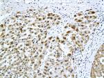 HBsAg Antibody in Immunohistochemistry (Paraffin) (IHC (P))