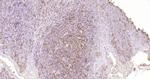 CD45 Antibody in Immunohistochemistry (Paraffin) (IHC (P))