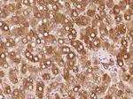 Cytokeratin 19 Antibody in Immunohistochemistry (Paraffin) (IHC (P))