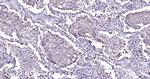 Cytokeratin 19 Antibody in Immunohistochemistry (Paraffin) (IHC (P))