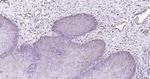 Cytokeratin 19 Antibody in Immunohistochemistry (Paraffin) (IHC (P))