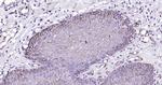 Cytokeratin 19 Antibody in Immunohistochemistry (Paraffin) (IHC (P))