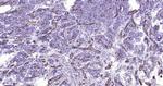 Cytokeratin 19 Antibody in Immunohistochemistry (Paraffin) (IHC (P))