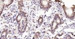 Cytokeratin 19 Antibody in Immunohistochemistry (Paraffin) (IHC (P))
