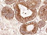 Cytokeratin 19 Antibody in Immunohistochemistry (Paraffin) (IHC (P))