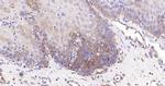 Cytokeratin 19 Antibody in Immunohistochemistry (Paraffin) (IHC (P))