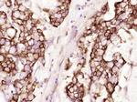 Cytokeratin 19 Antibody in Immunohistochemistry (Paraffin) (IHC (P))