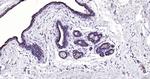 Cytokeratin 19 Antibody in Immunohistochemistry (Paraffin) (IHC (P))