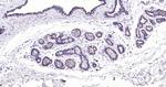 Cytokeratin 19 Antibody in Immunohistochemistry (Paraffin) (IHC (P))