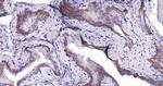 Cytokeratin 19 Antibody in Immunohistochemistry (Paraffin) (IHC (P))