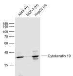 Cytokeratin 19 Antibody in Western Blot (WB)