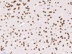 Histone H3 (Di methyl K79) Antibody in Immunohistochemistry (Paraffin) (IHC (P))