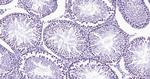 Histone H3 (tri methyl K79) Antibody in Immunohistochemistry (Paraffin) (IHC (P))