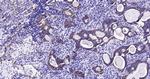 CK18 Antibody in Immunohistochemistry (Paraffin) (IHC (P))