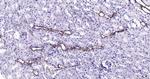 CK18 Antibody in Immunohistochemistry (Paraffin) (IHC (P))