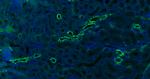 CK18 Antibody in Immunohistochemistry (Paraffin) (IHC (P))