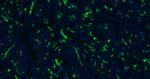 CK18 Antibody in Immunohistochemistry (Paraffin) (IHC (P))