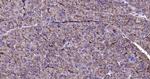 CK18 Antibody in Immunohistochemistry (Paraffin) (IHC (P))