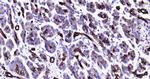 CK18 Antibody in Immunohistochemistry (Paraffin) (IHC (P))