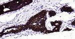 CK18 Antibody in Immunohistochemistry (Paraffin) (IHC (P))