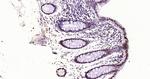 Histone H3 (di methyl K27) Antibody in Immunohistochemistry (Paraffin) (IHC (P))