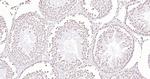 Histone H3 (di methyl K27) Antibody in Immunohistochemistry (Paraffin) (IHC (P))