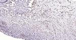 Histone H3 (di methyl K27) Antibody in Immunohistochemistry (Paraffin) (IHC (P))