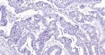 Histone H3 (di methyl K27) Antibody in Immunohistochemistry (Paraffin) (IHC (P))