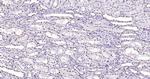 Histone H3 (di methyl K27) Antibody in Immunohistochemistry (Paraffin) (IHC (P))