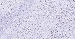 Histone H3 (di methyl K27) Antibody in Immunohistochemistry (Paraffin) (IHC (P))