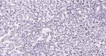 Histone H3 (di methyl K27) Antibody in Immunohistochemistry (Paraffin) (IHC (P))