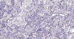 Histone H3 (di methyl K27) Antibody in Immunohistochemistry (Paraffin) (IHC (P))