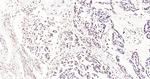 Histone H3 (di methyl K27) Antibody in Immunohistochemistry (Paraffin) (IHC (P))